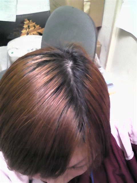 hair